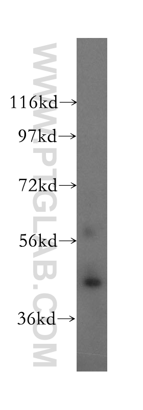 Cytohesin 3