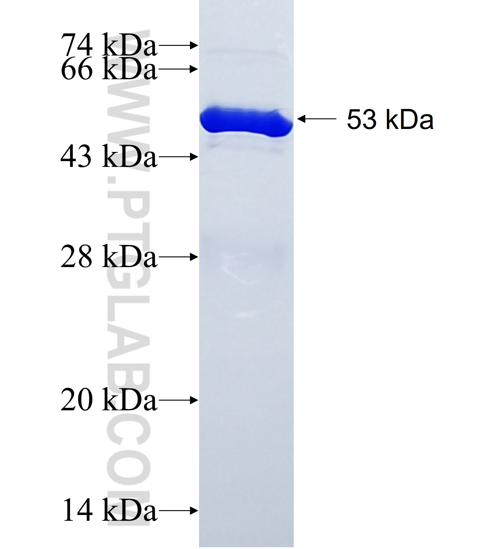 CYTIP fusion protein Ag39917 SDS-PAGE