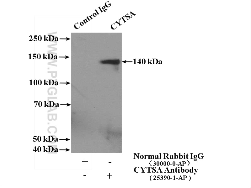 IP experiment of mouse brain using 25390-1-AP