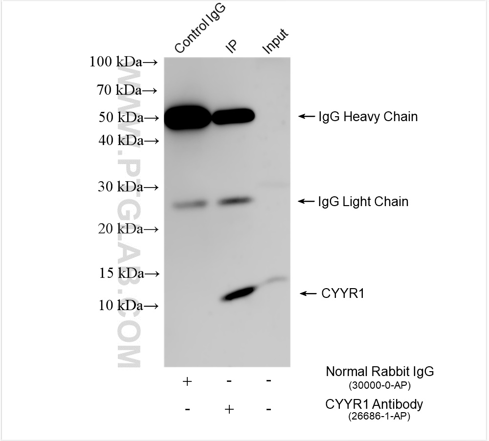 IP experiment of mouse pancreas using 26686-1-AP