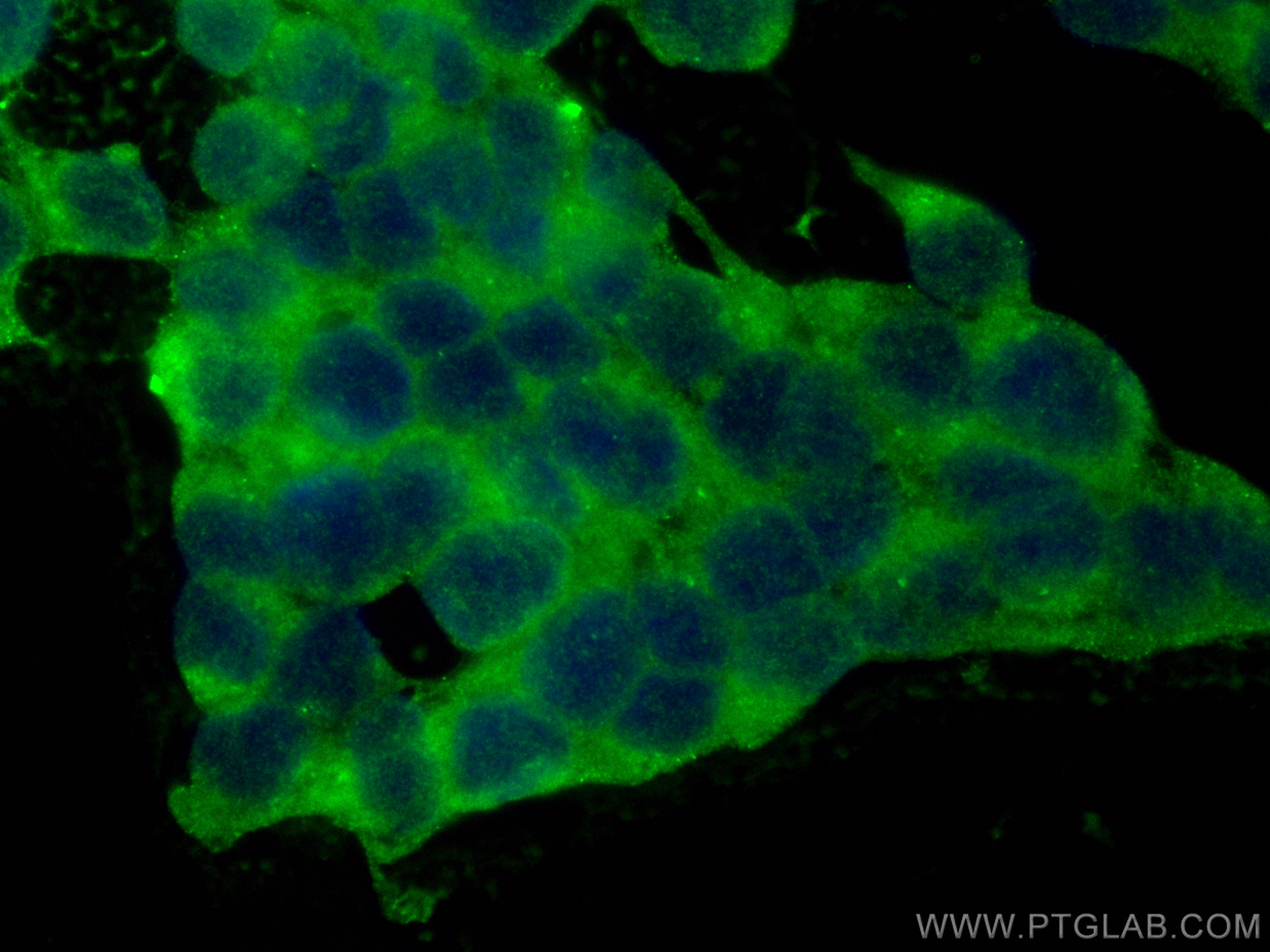 IF Staining of SH-SY5Y using CL488-13730