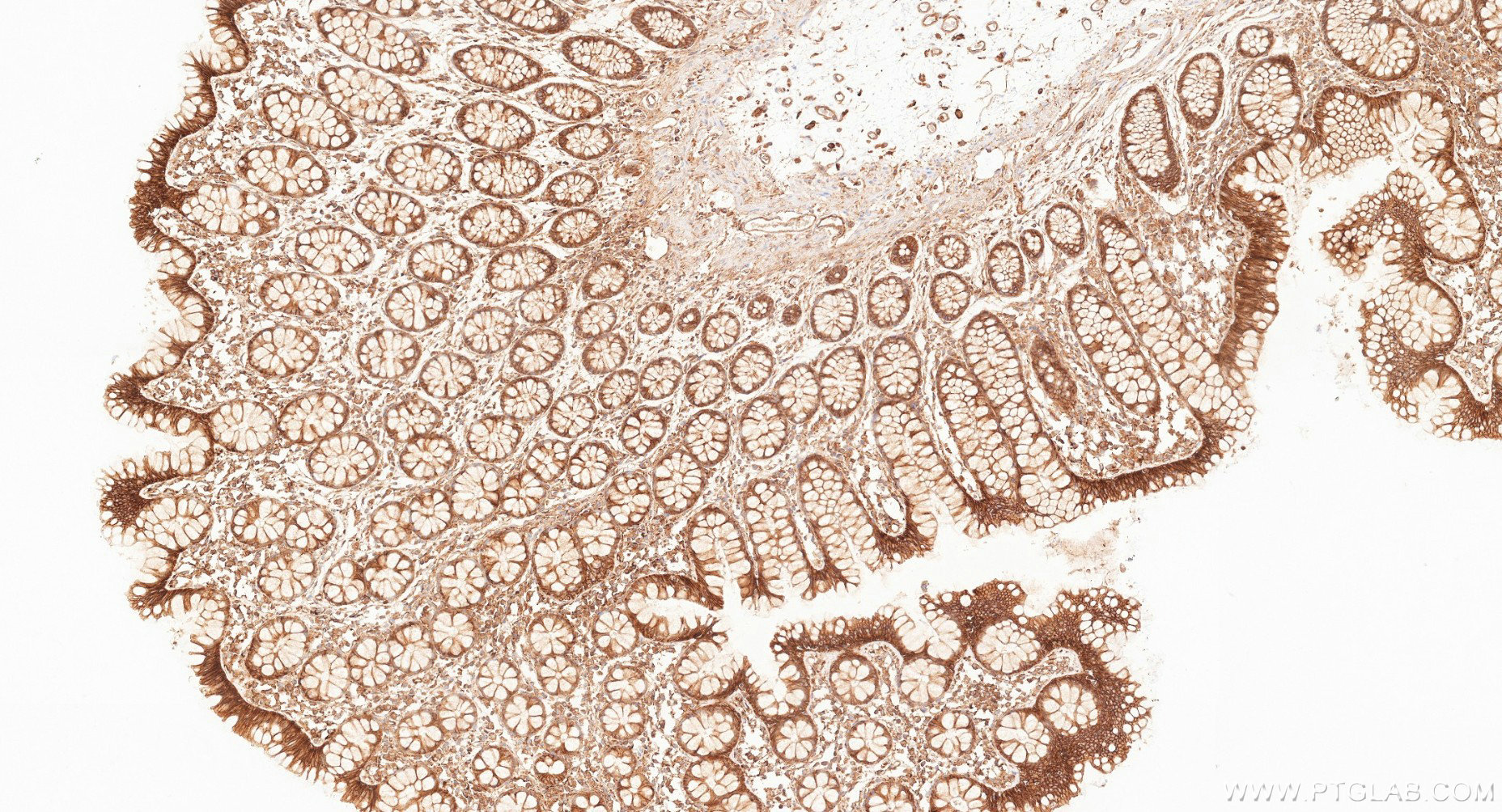 IHC staining of human large intestine using 87073-2-RR (same clone as 87073-2-PBS) IHC staining of human large intestine using 87073-2-RR (same clone as 87073-2-PBS)