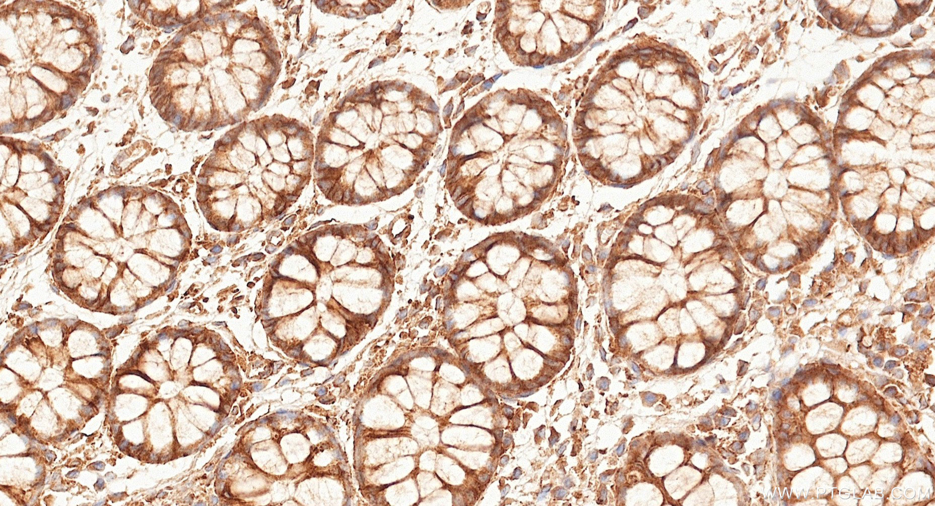 IHC staining of human large intestine using 87073-2-RR (same clone as 87073-2-PBS) IHC staining of human large intestine using 87073-2-RR (same clone as 87073-2-PBS)