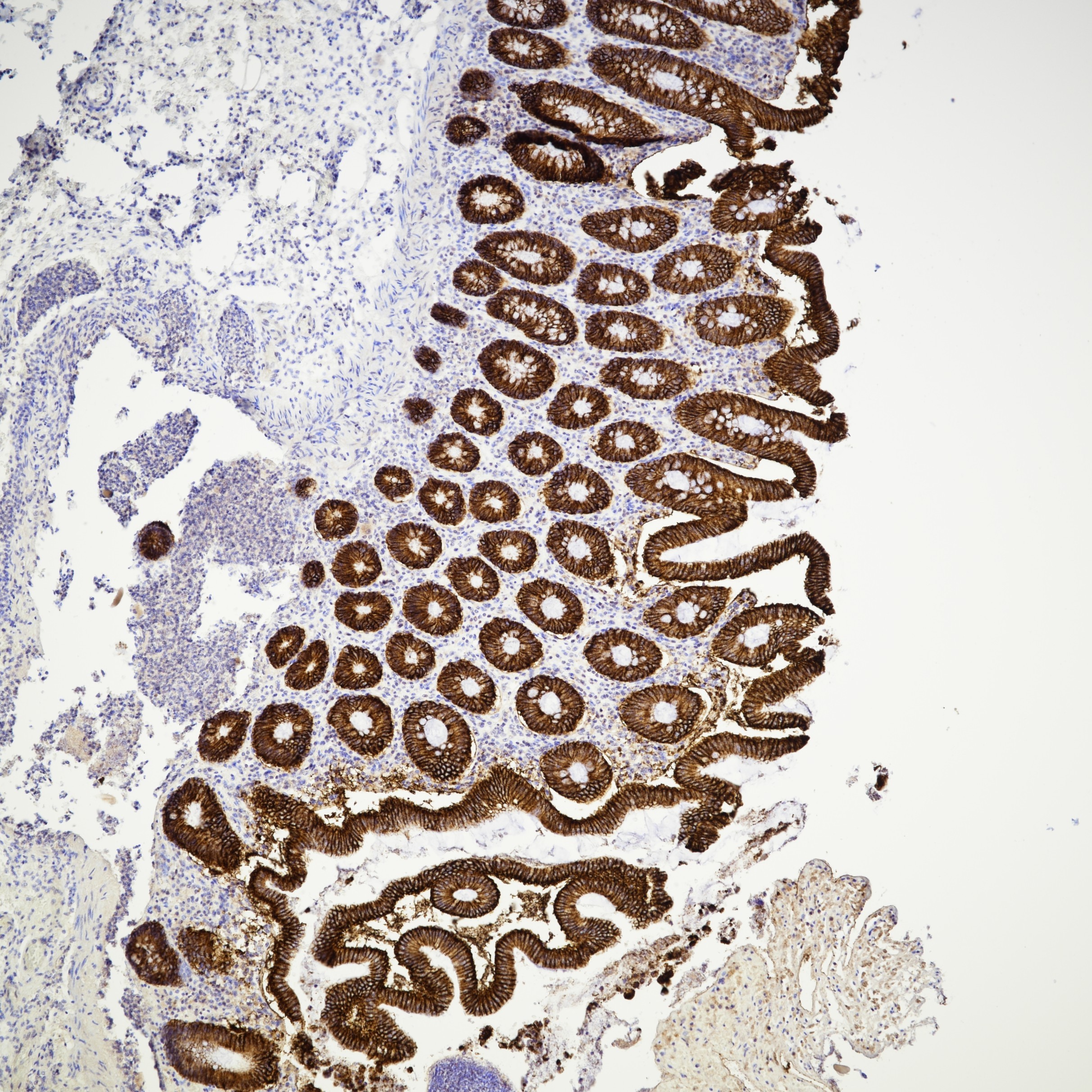 IHC staining of human colon using 83793-5-RR