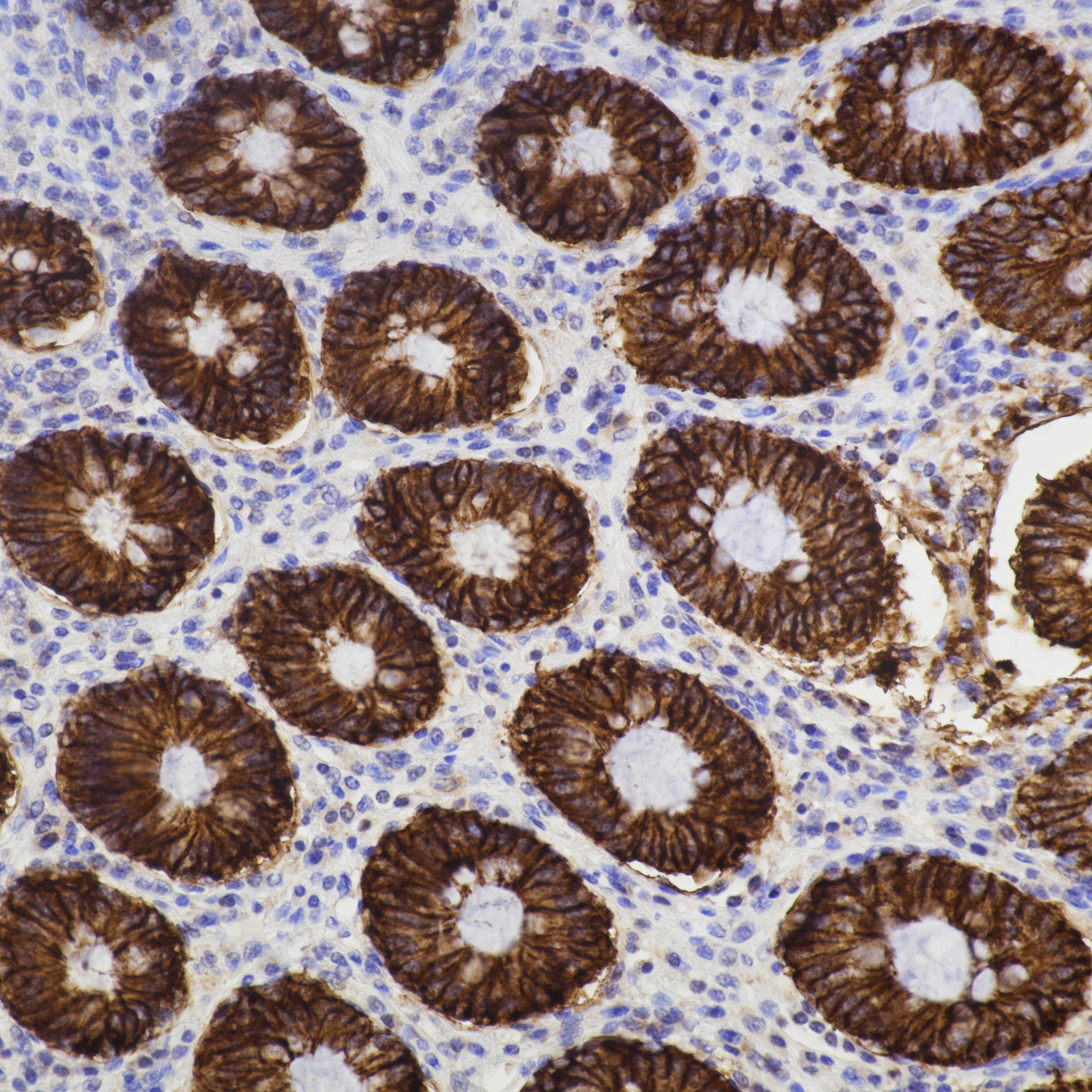 IHC staining of human colon using 83793-5-RR