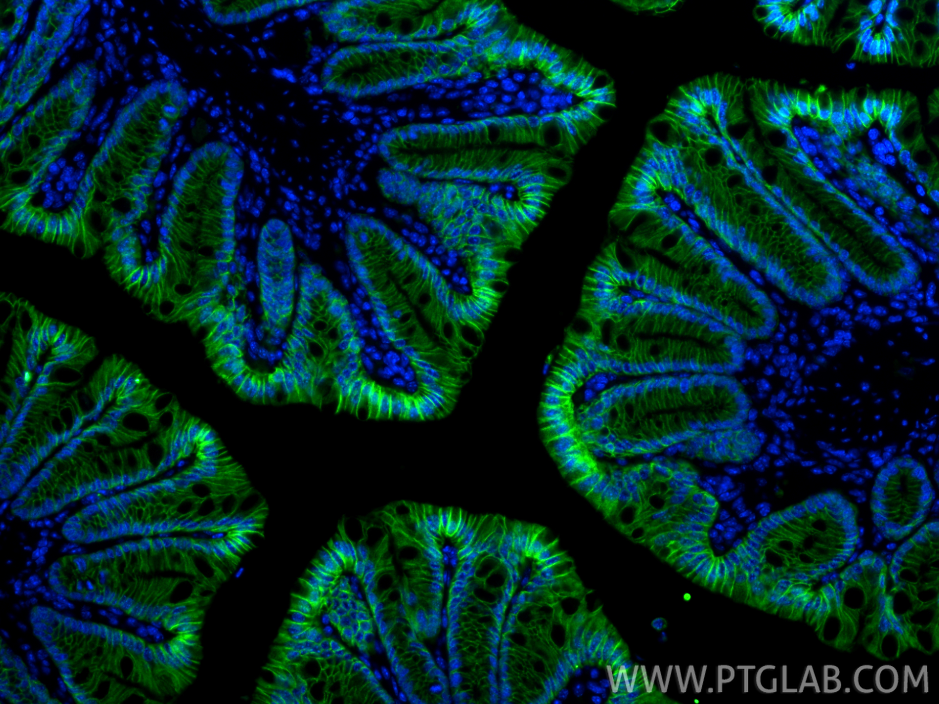 IF Staining of mouse colon using CL488-83793-5