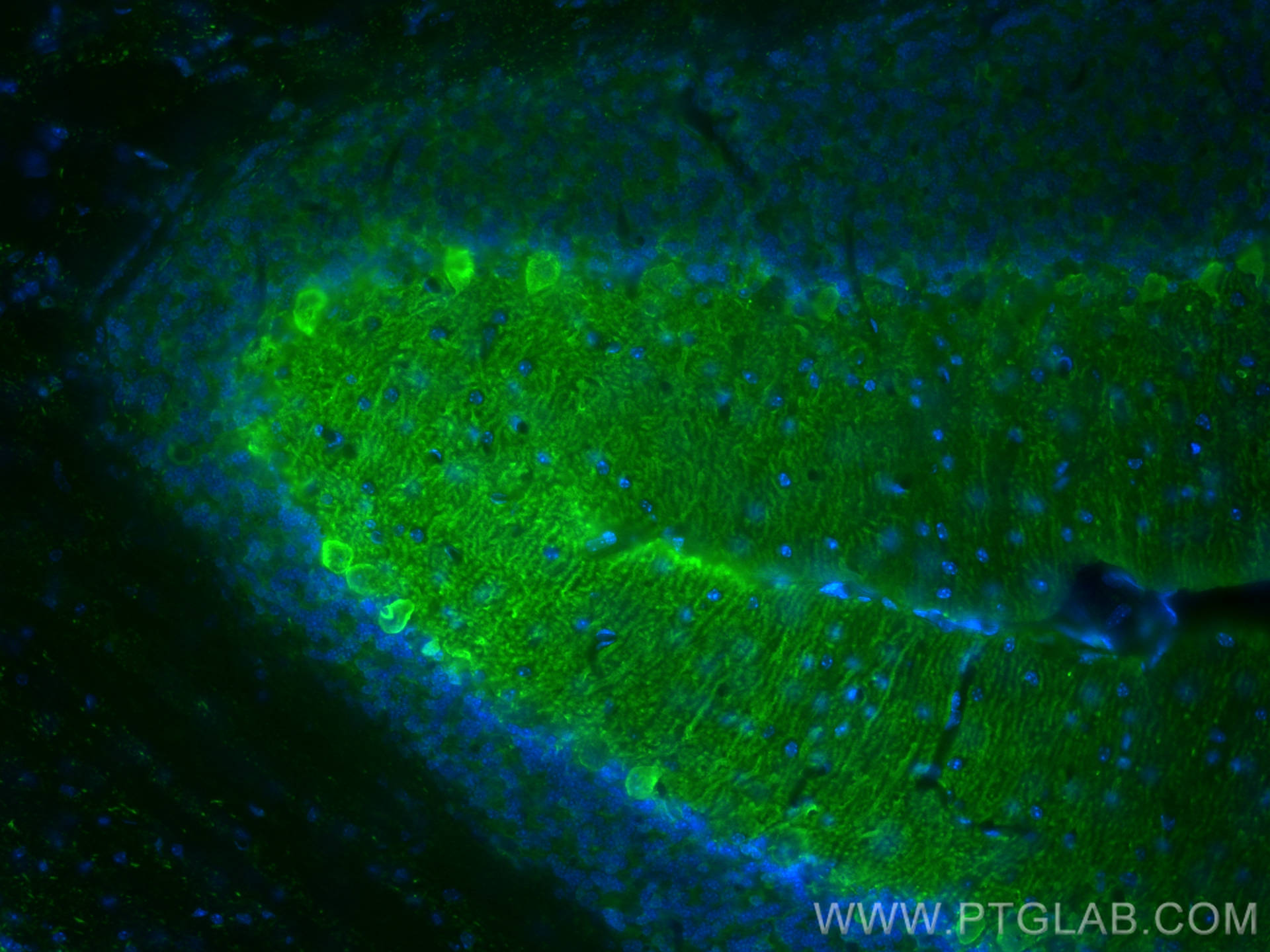 IF Staining of mouse cerebellum using 66394-1-Ig