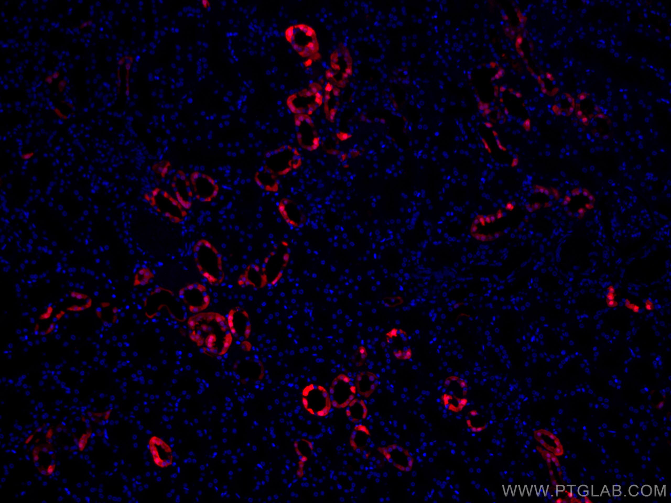 IF Staining of human kidney using CL594-14479