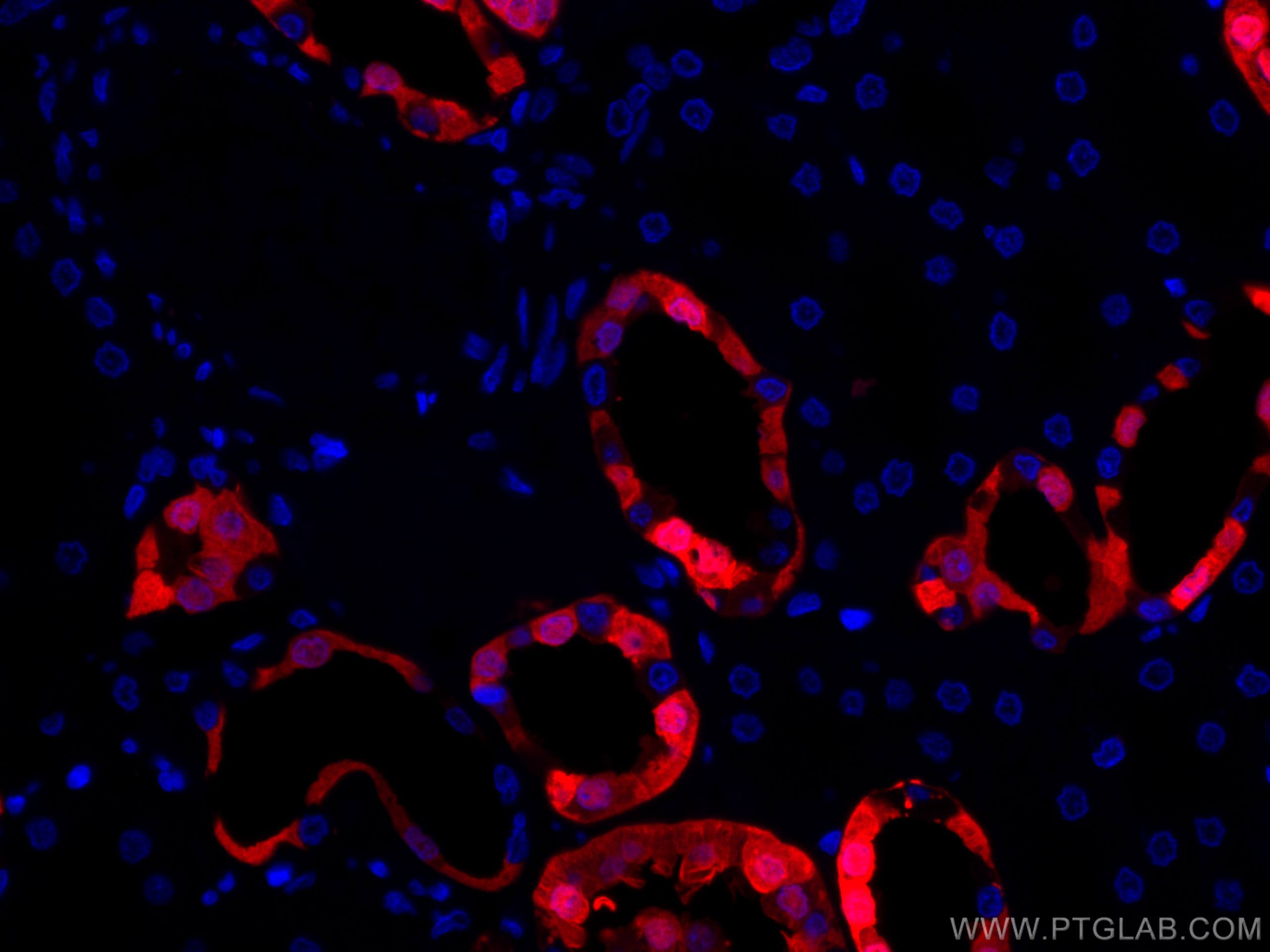 IF Staining of human kidney using CL594-14479