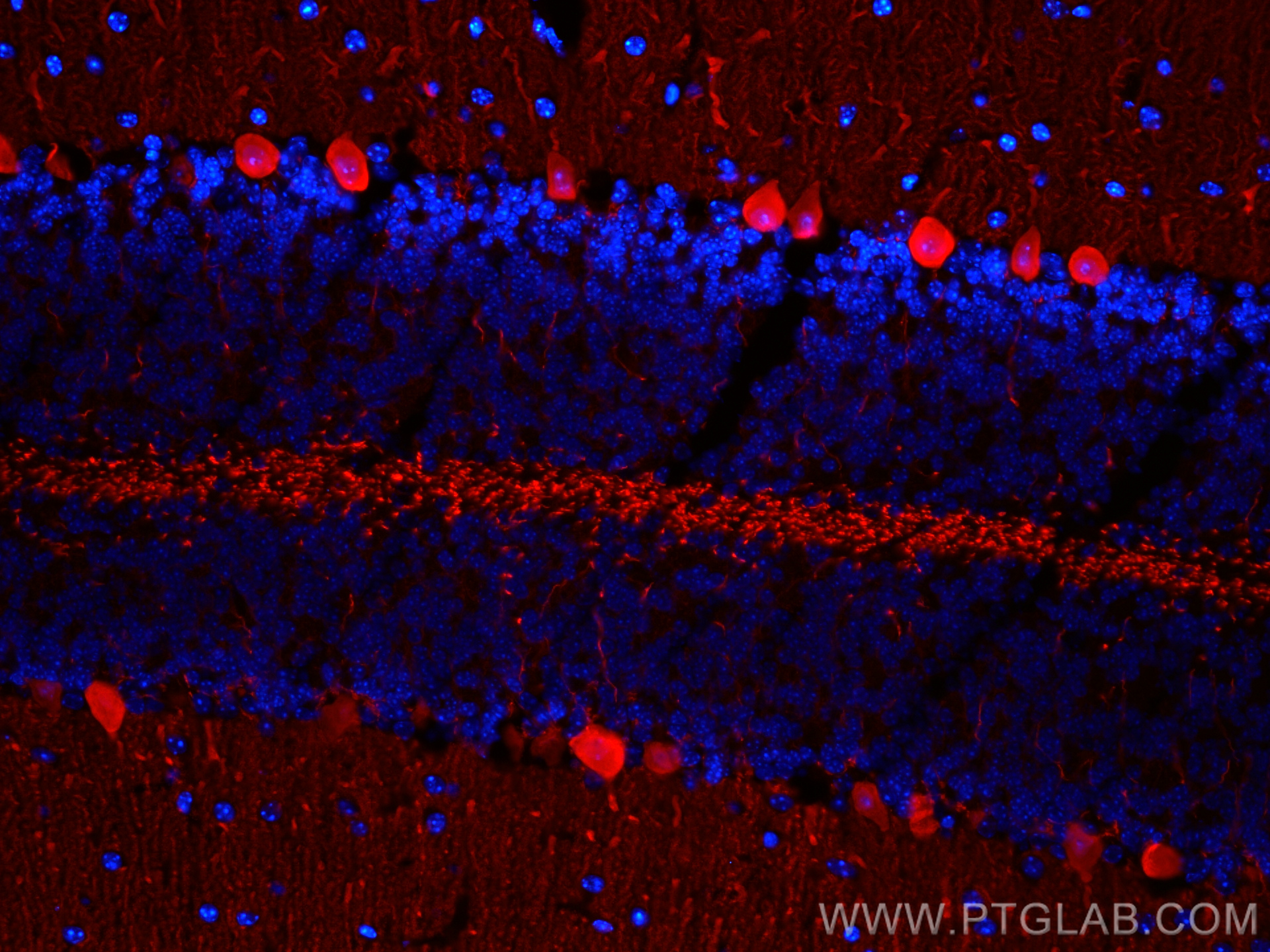 IF Staining of mouse cerebellum using CL594-14479