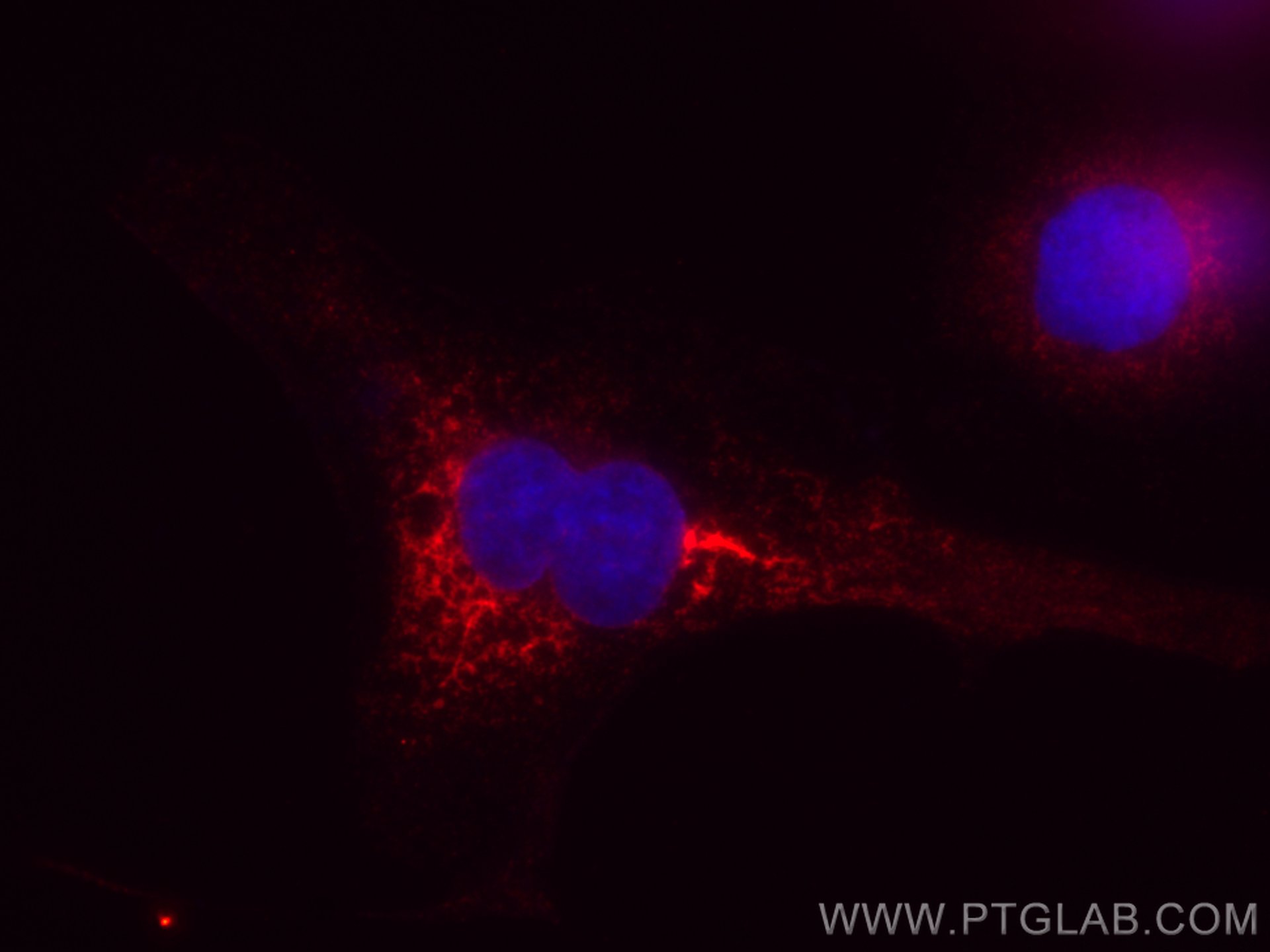 IF Staining of SKOV-3 using CL594-66903