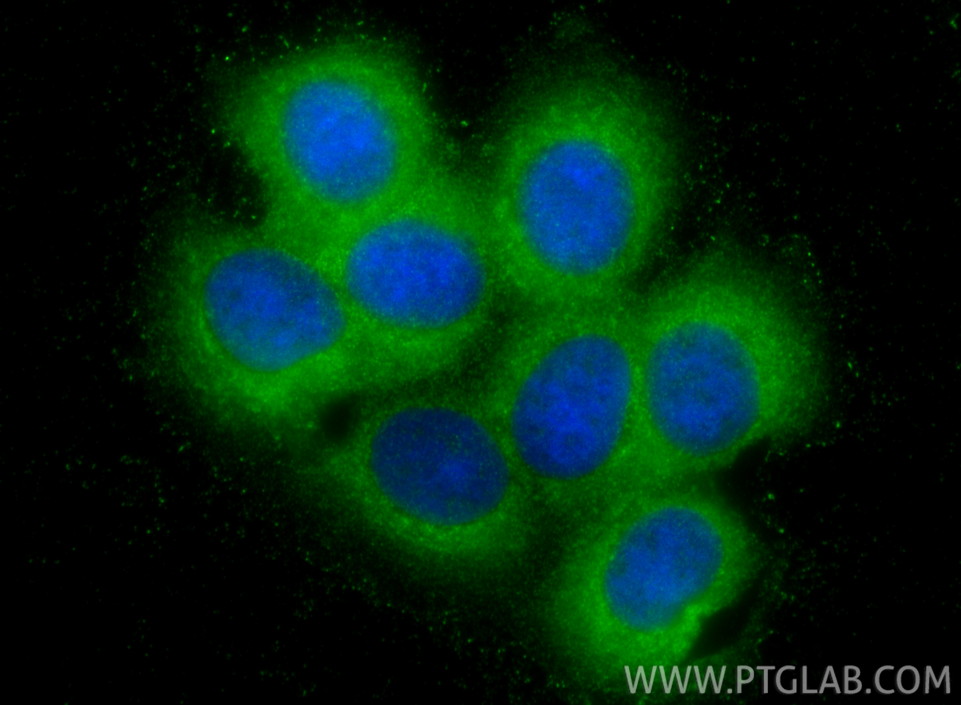 IF Staining of MCF-7 using 33924-1-AP