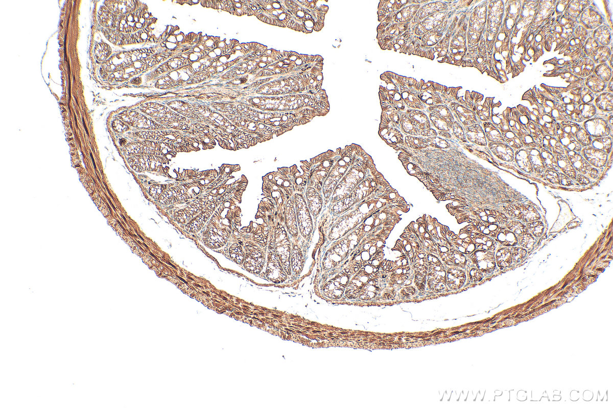 IHC staining of mouse colon using 33924-1-AP IHC staining of mouse colon using 33924-1-AP
