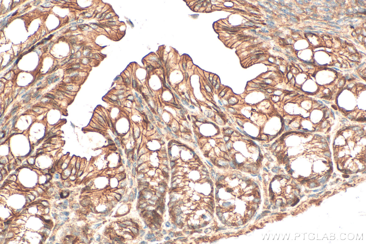 IHC staining of mouse colon using 33924-1-AP IHC staining of mouse colon using 33924-1-AP
