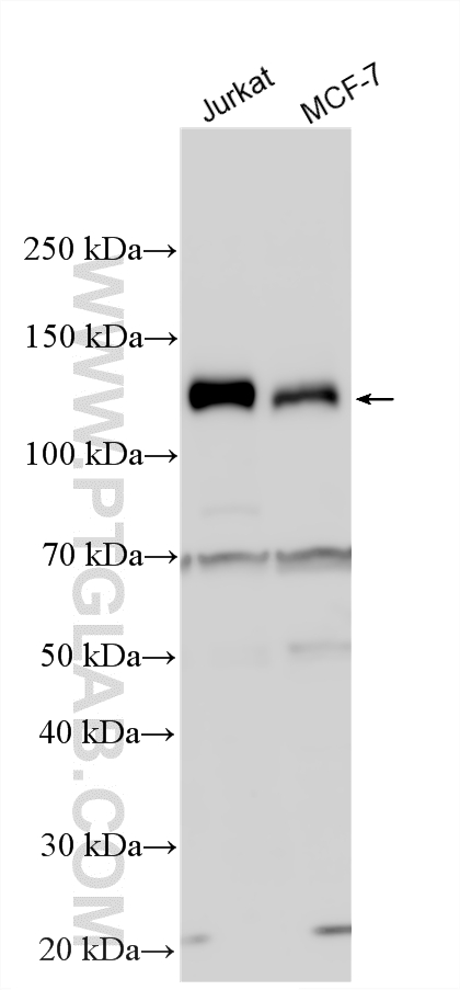 WB analysis using 33924-1-AP (same clone as 33924-1-PBS)