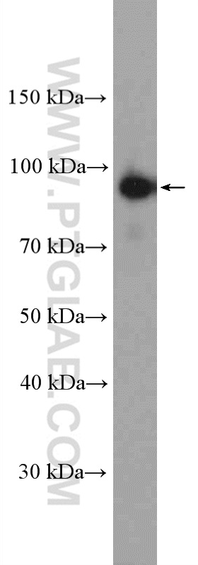 WB analysis of mouse brain using 26985-1-AP