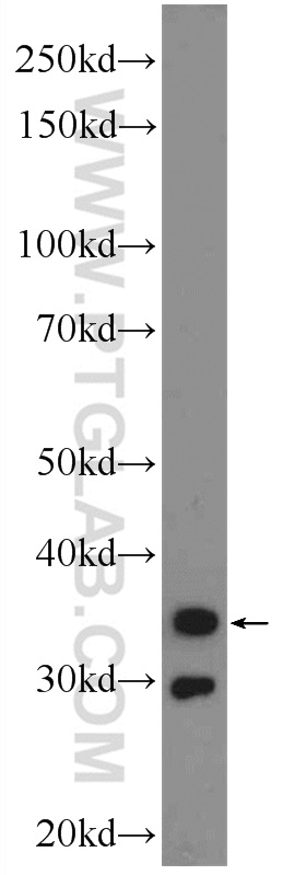 WB analysis of mouse stomach using 24855-1-AP