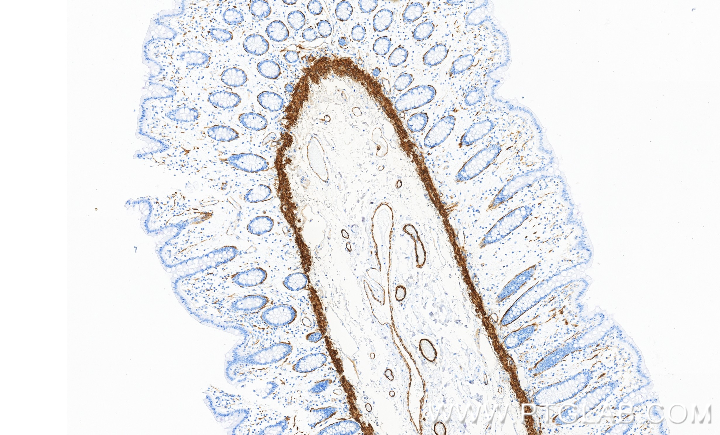 IHC staining of human colon using 86977-4-RR (same clone as 86977-4-PBS)