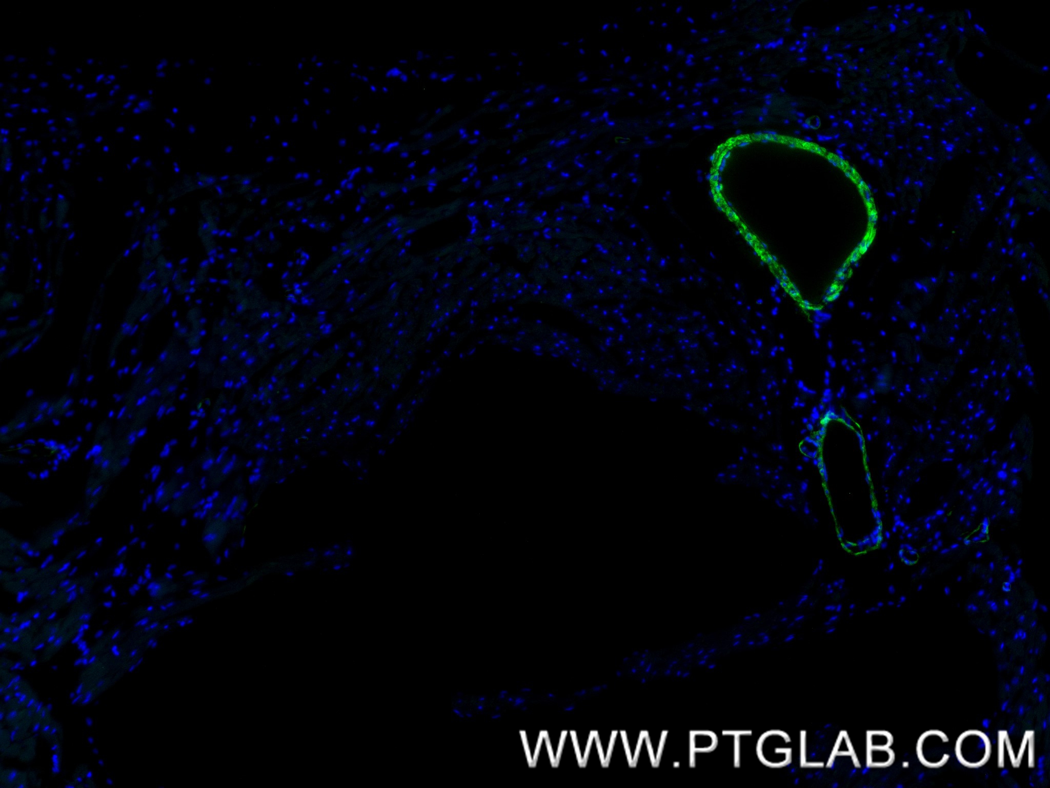 IF Staining of mouse heart using 86977-4-RR (same clone as 86977-4-PBS)