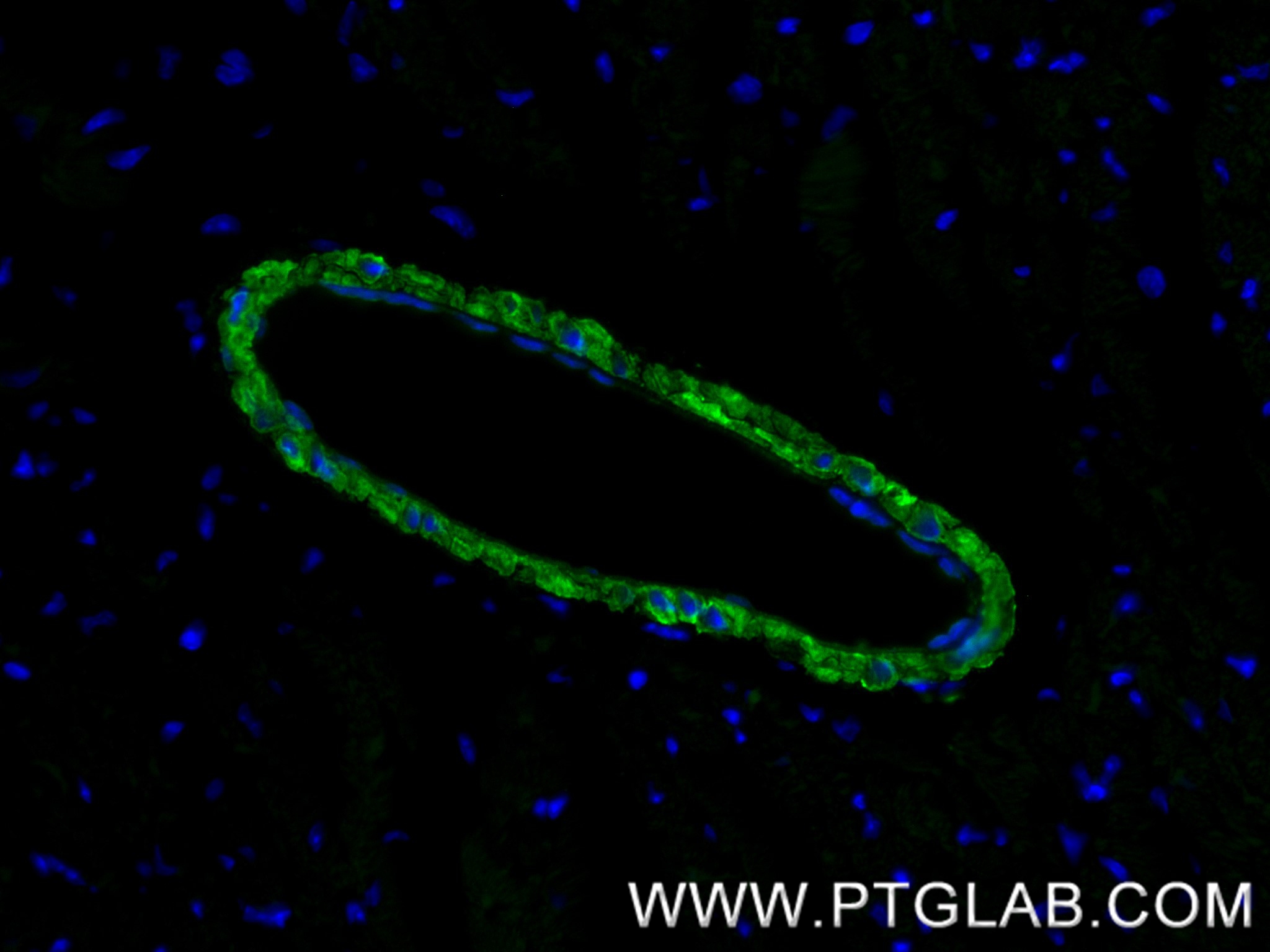 IF Staining of mouse heart using 86977-4-RR (same clone as 86977-4-PBS)