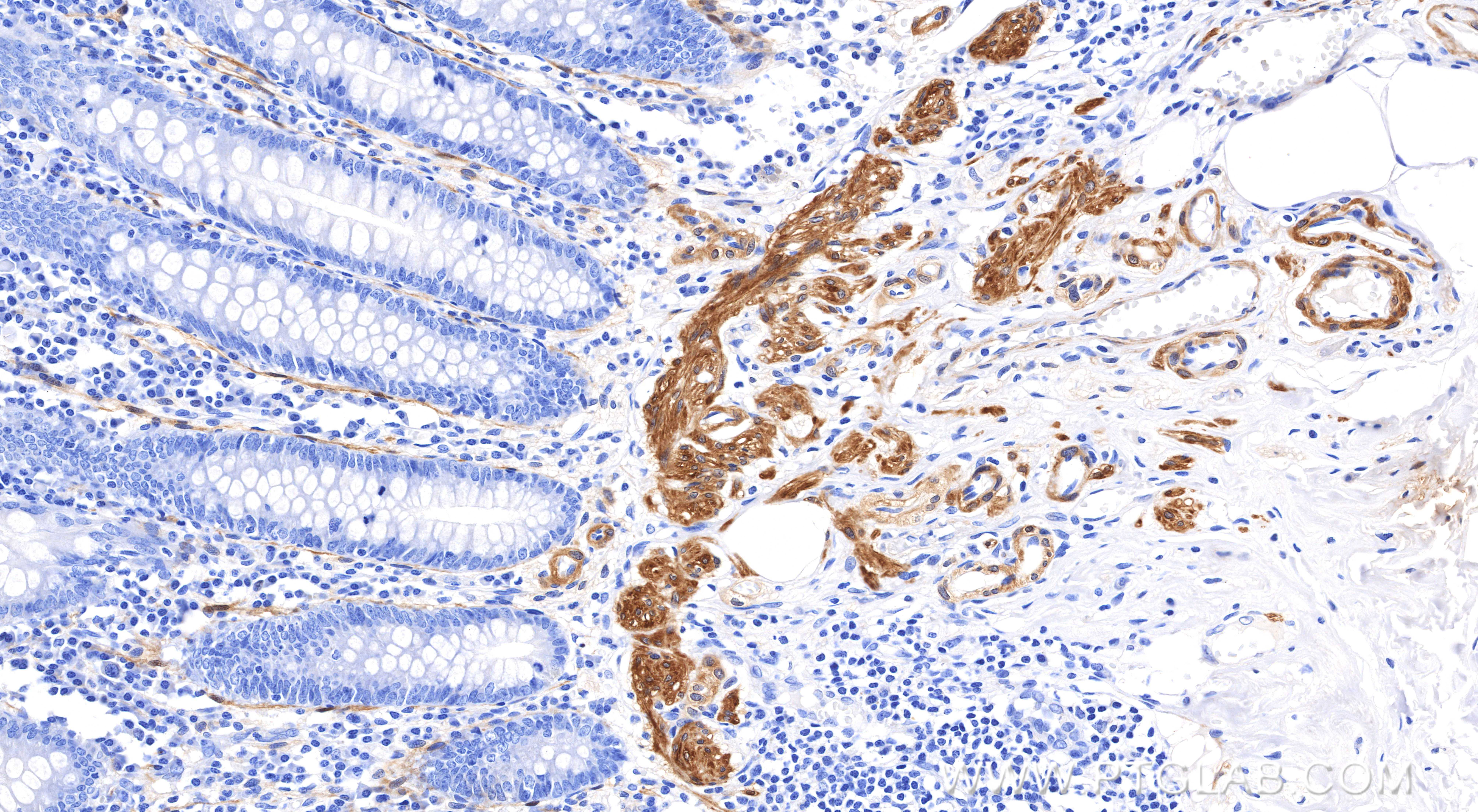 IHC staining of human appendix using 86977-4-RR (same clone as 86977-4-PBS)