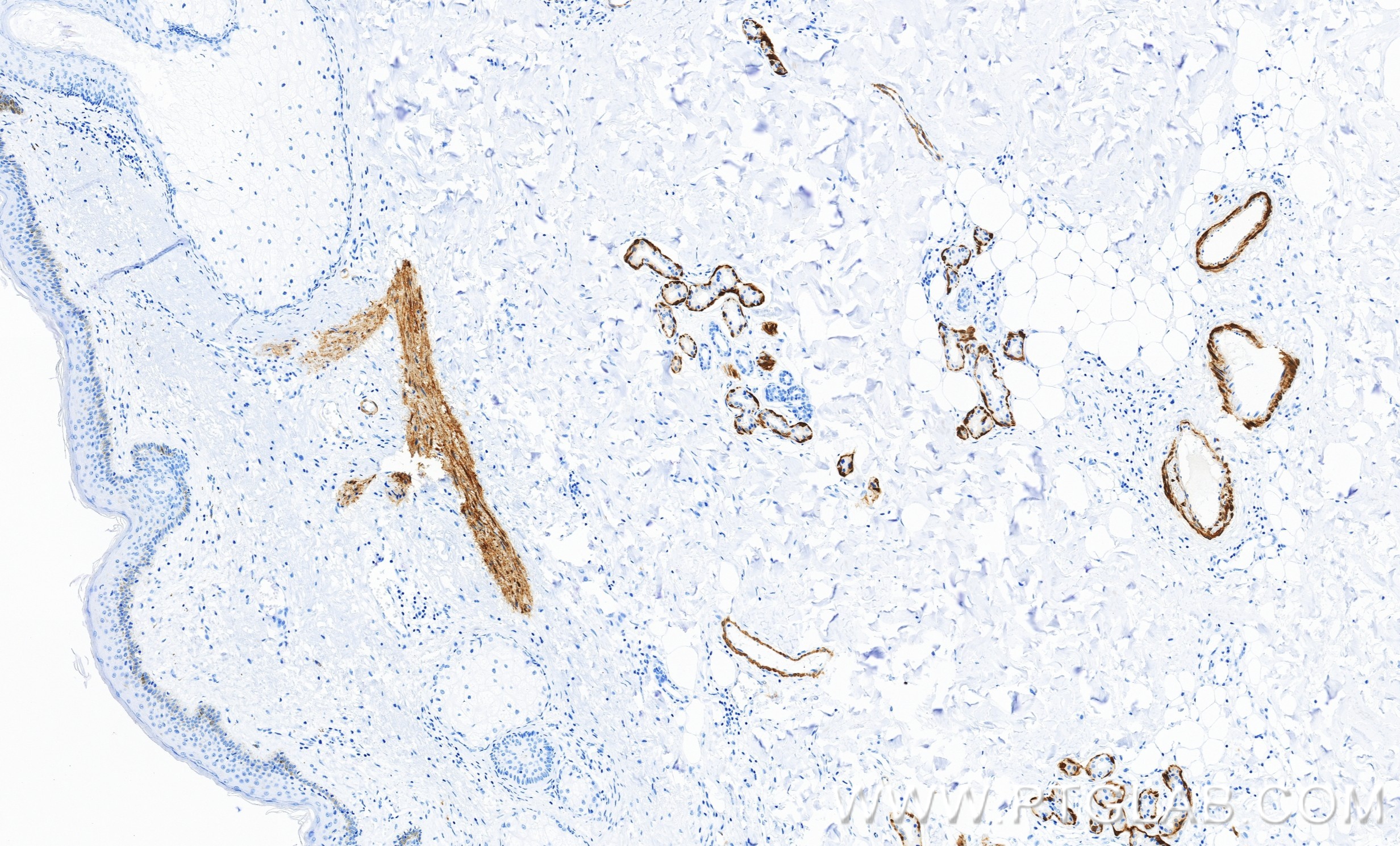 IHC staining of human skin using 86977-4-RR (same clone as 86977-4-PBS)