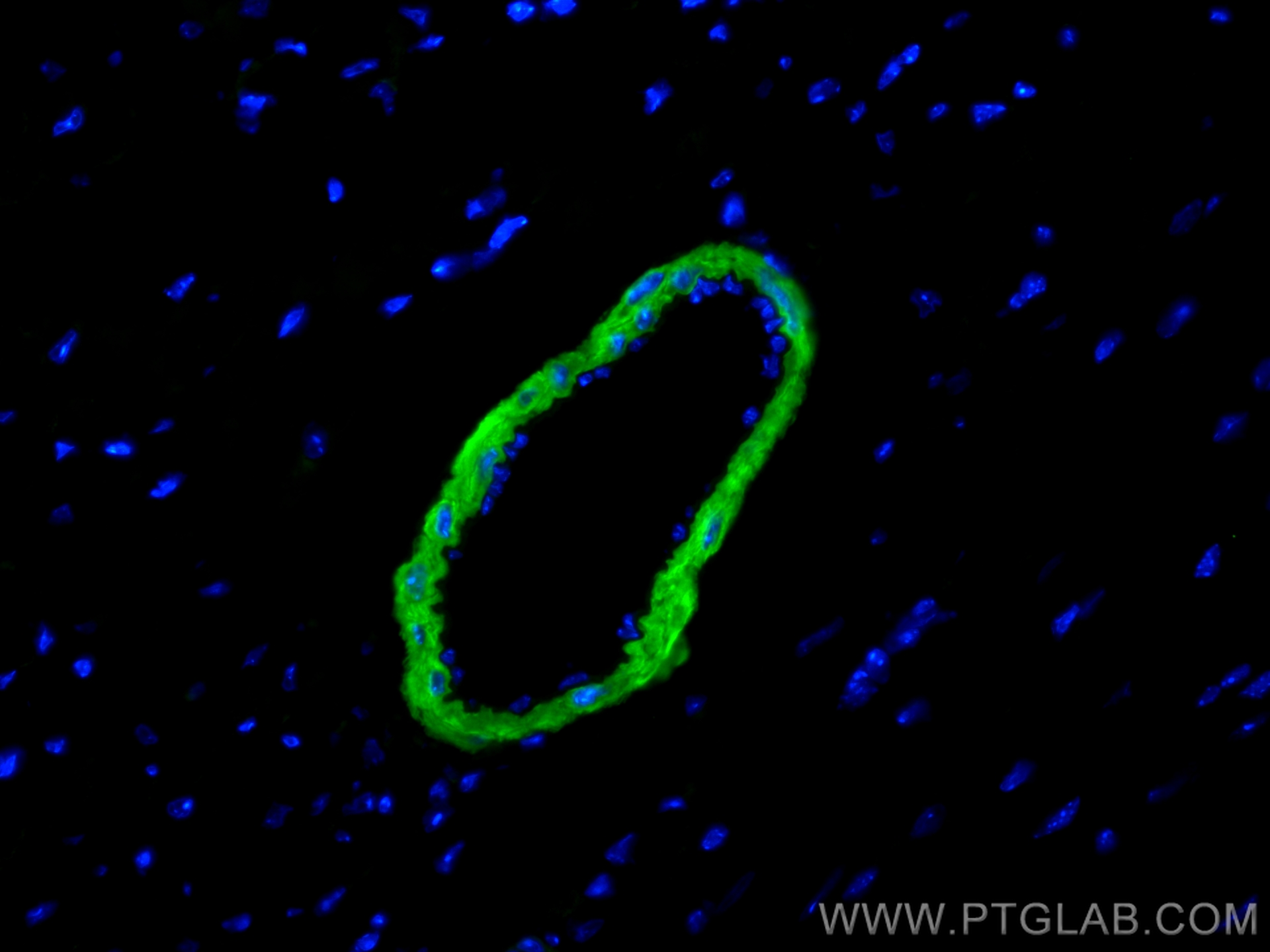 IF Staining of mouse heart using CL488-13938