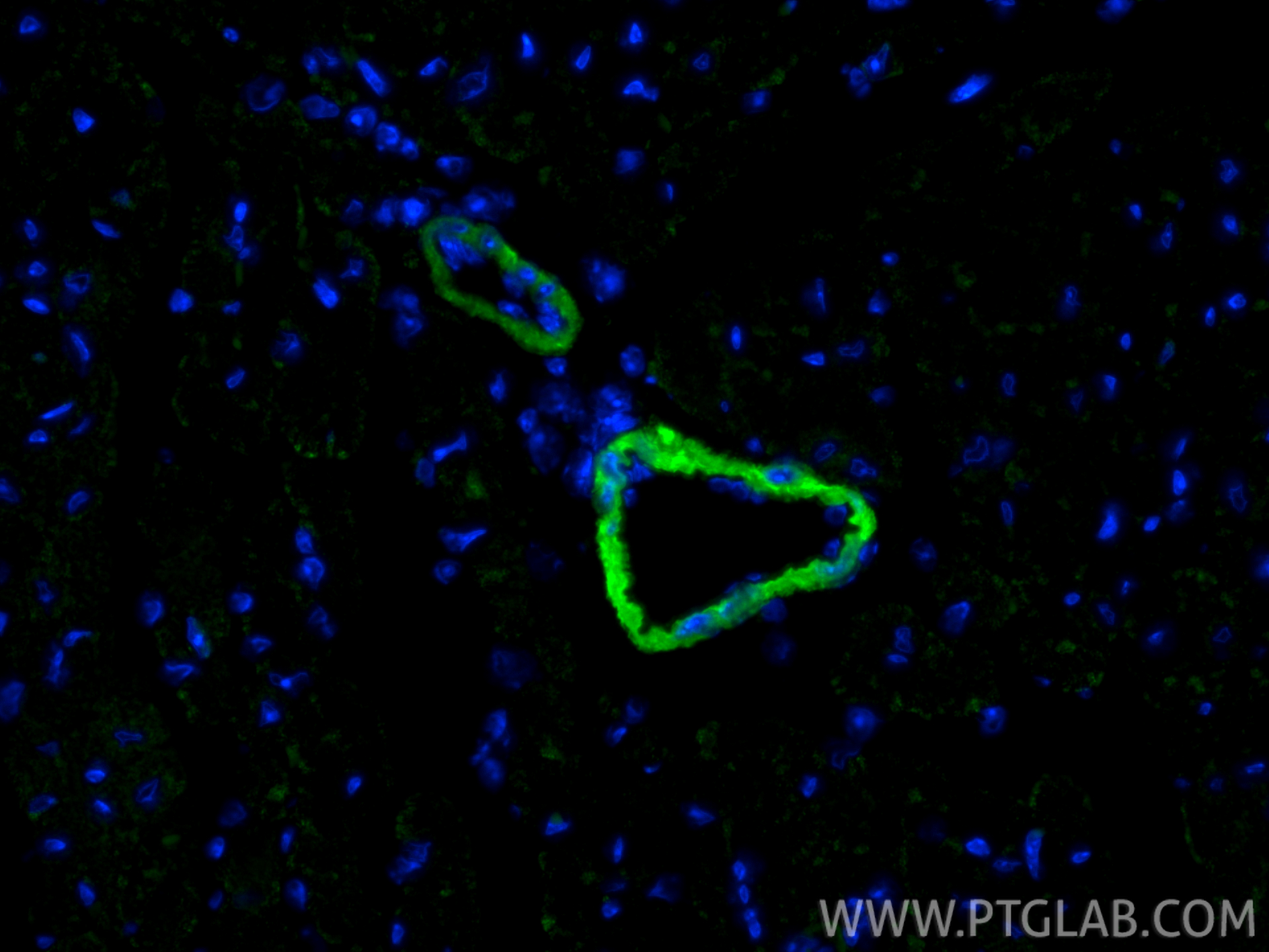 IF Staining of mouse heart using CL488-86977-4 IF Staining of mouse heart using CL488-86977-4