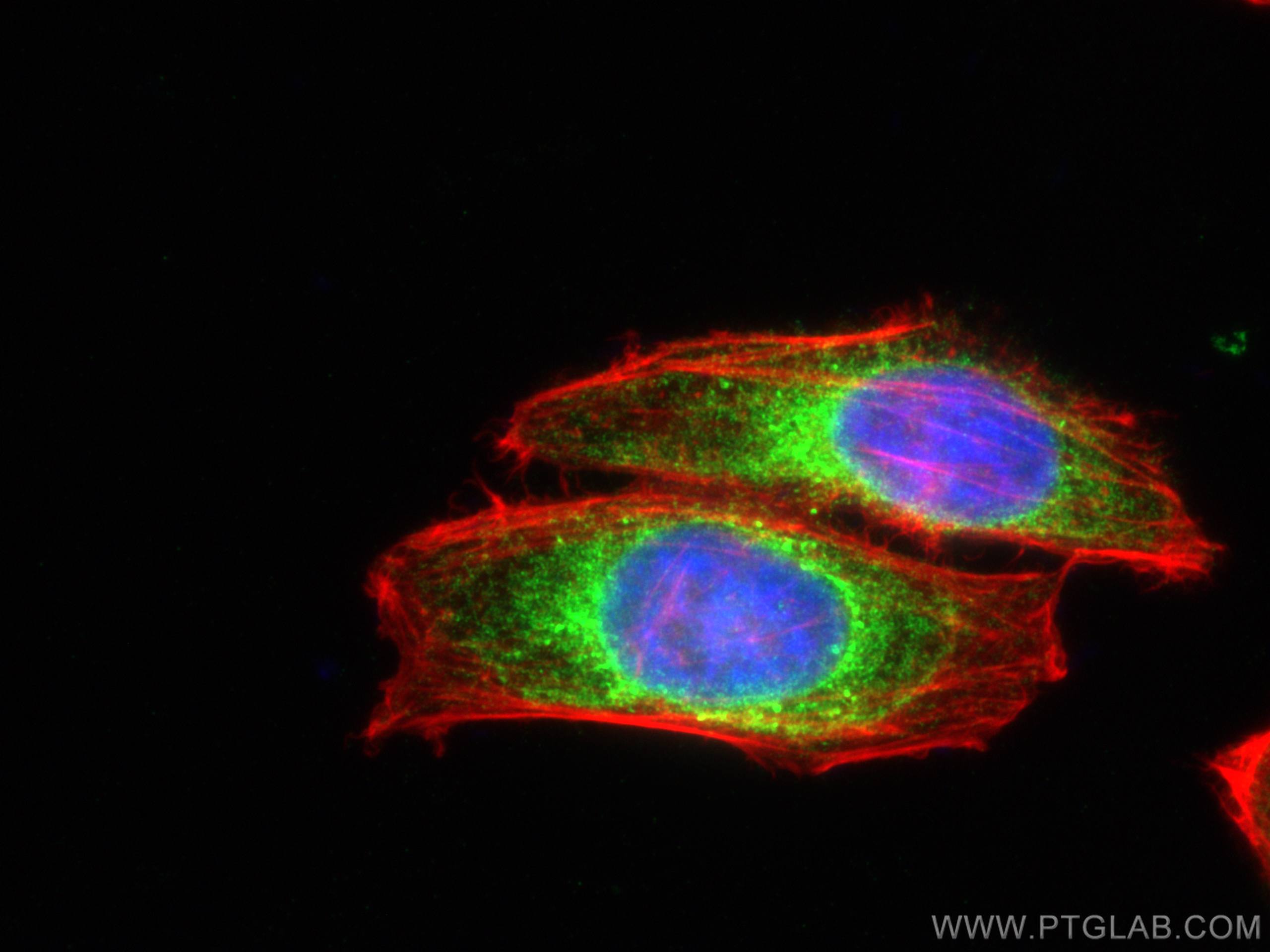 IF Staining of HepG2 using 27298-1-AP