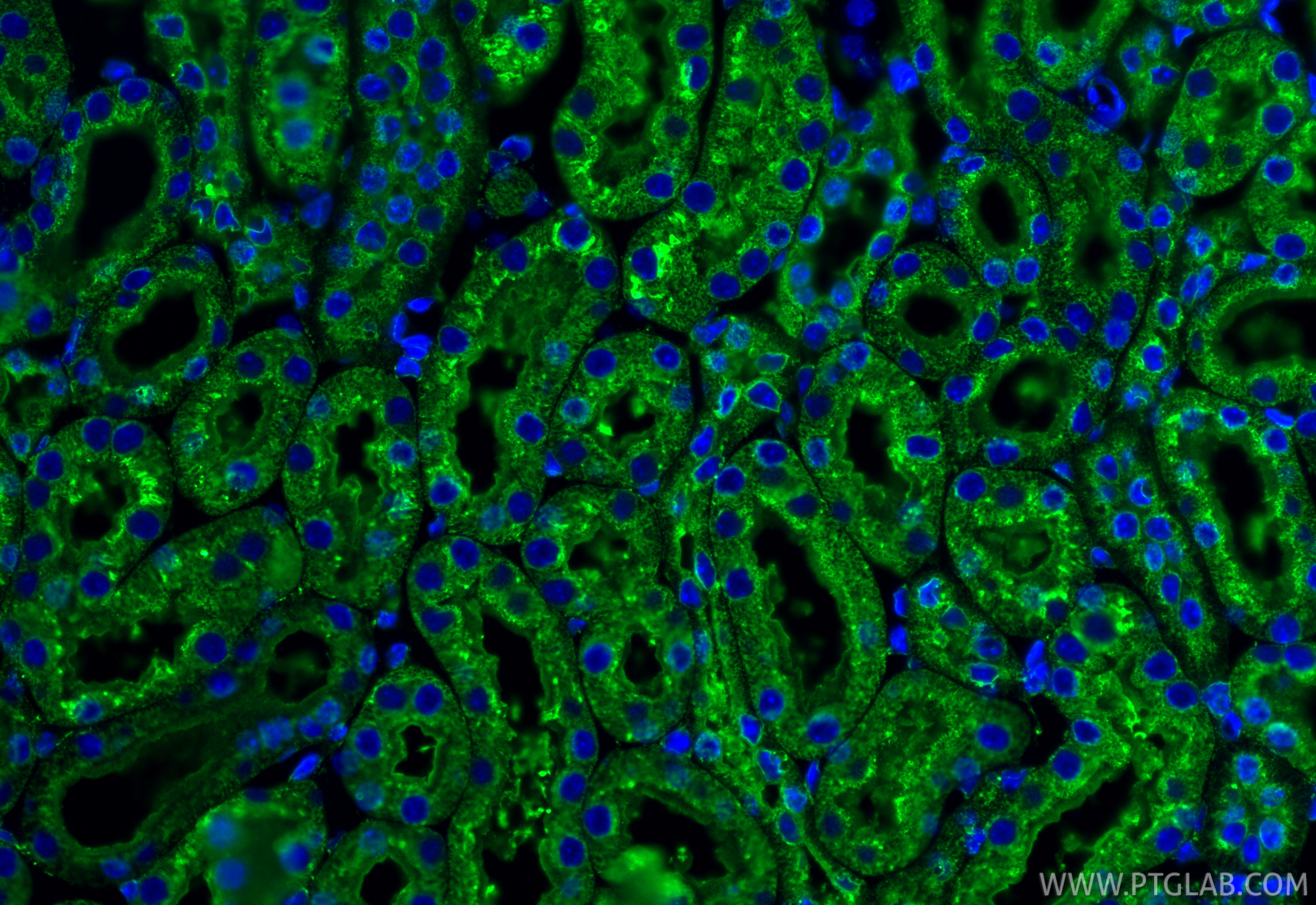 IF Staining of mouse kidney using 27298-1-AP