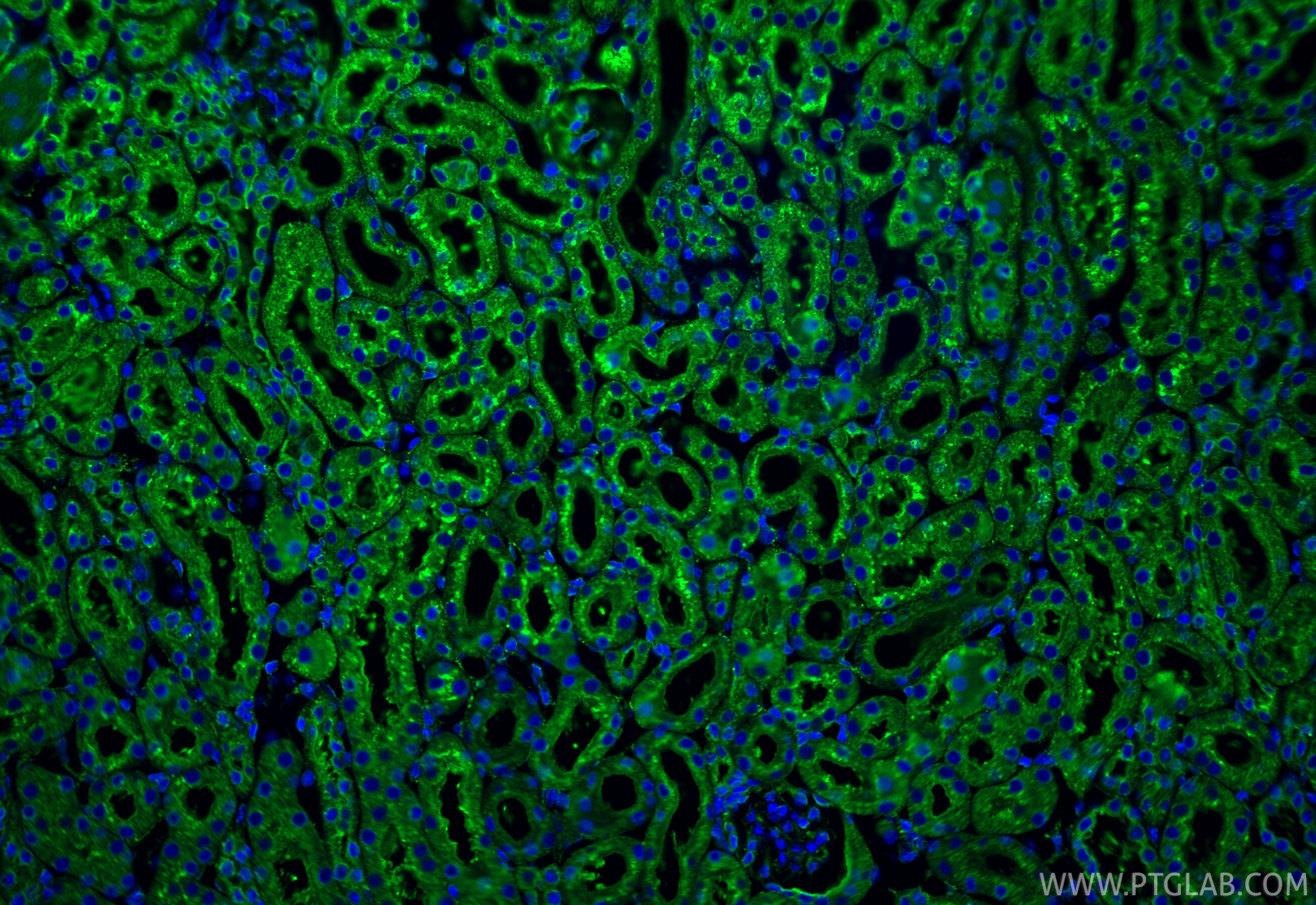 IF Staining of mouse kidney using 27298-1-AP