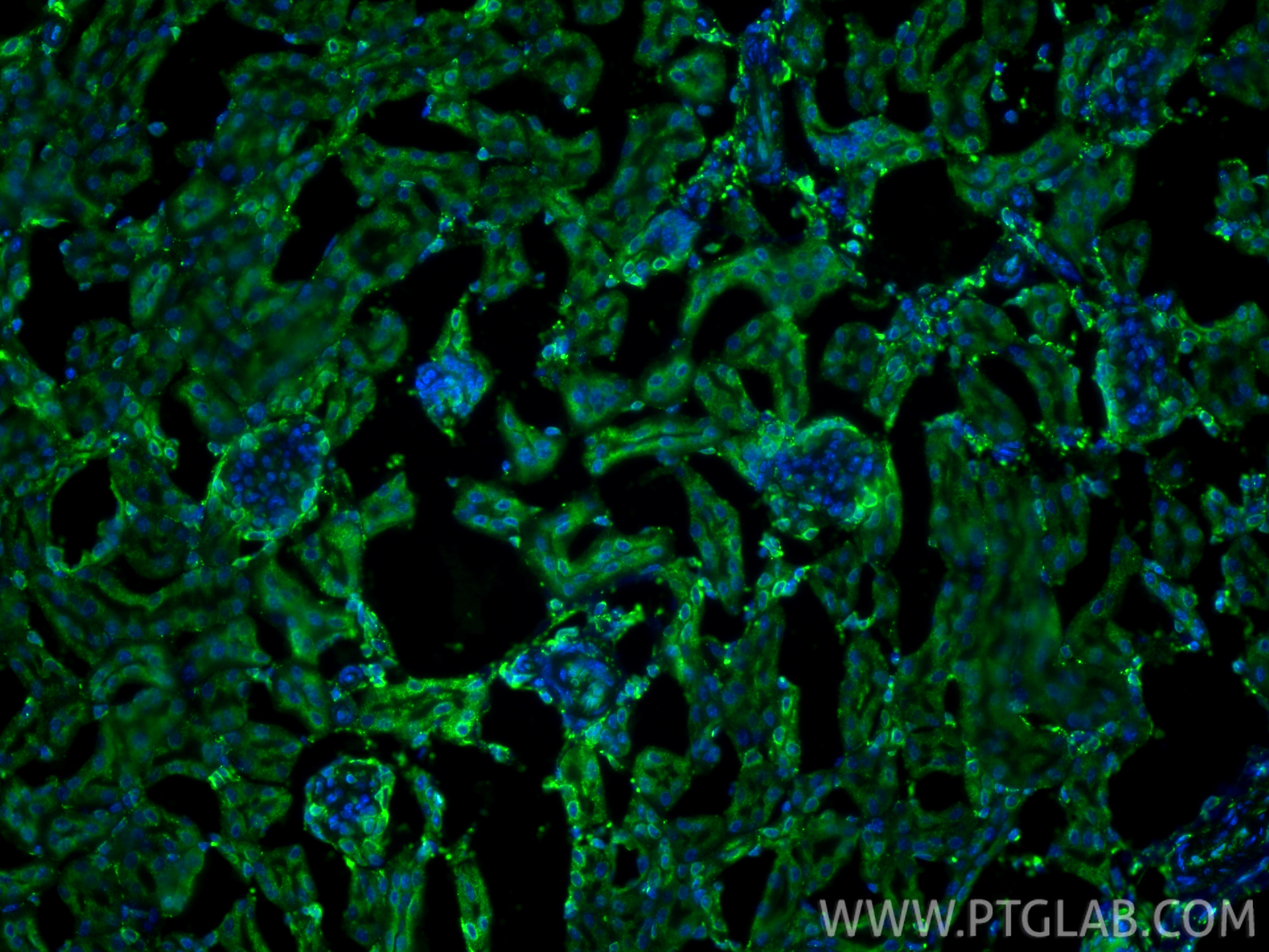 IF Staining of mouse kidney using 27298-1-AP IF Staining of mouse kidney using 27298-1-AP