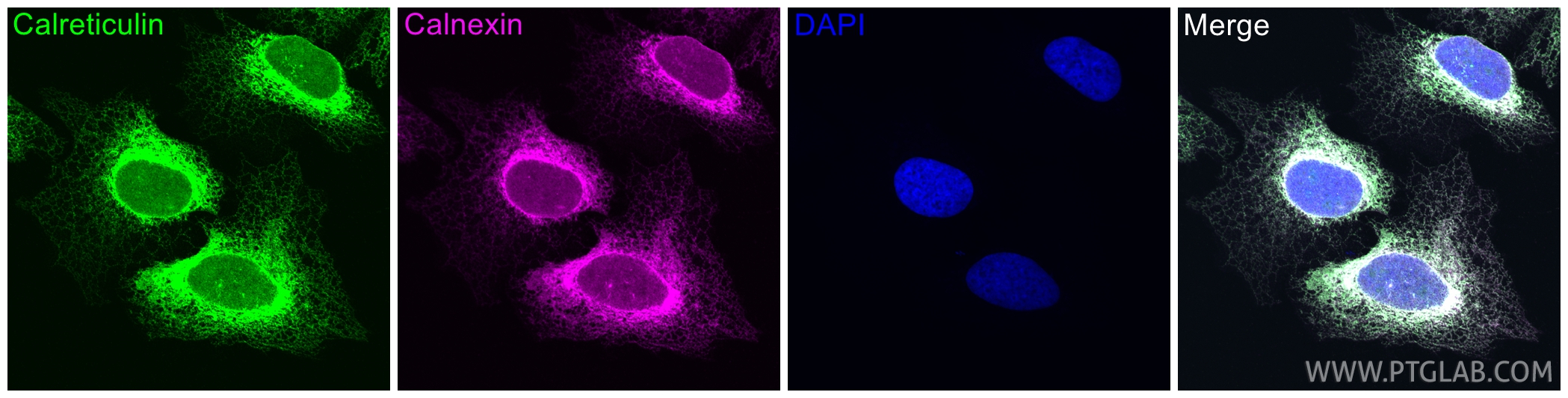 IF Staining of U2OS using 27298-1-AP IF Staining of U2OS using 27298-1-AP