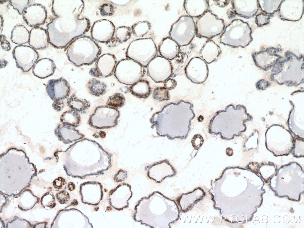 IHC staining of human thyroid using 27298-1-AP