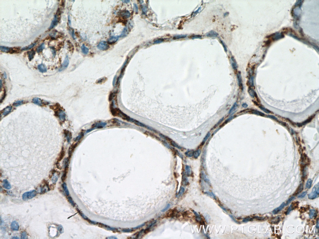 IHC staining of human thyroid using 27298-1-AP