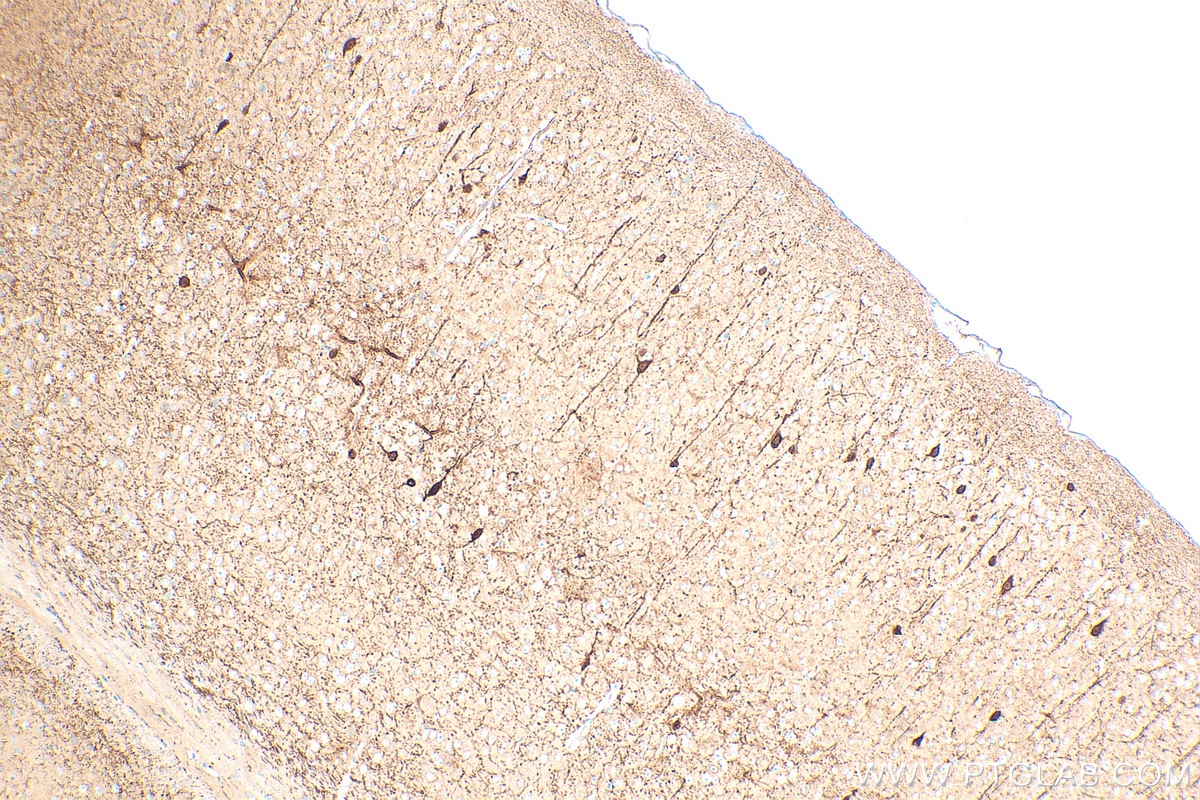 IHC staining of mouse brain using 82811-1-RR