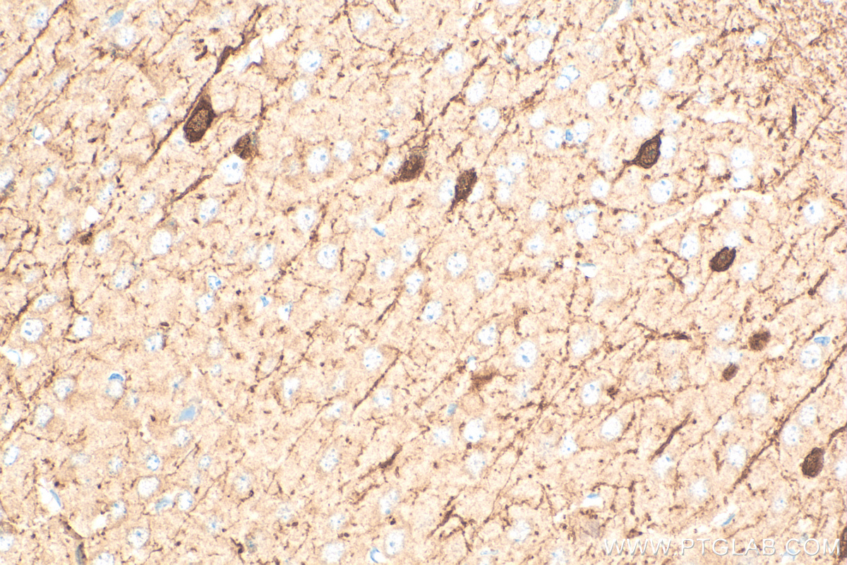 IHC staining of mouse brain using 82811-1-RR