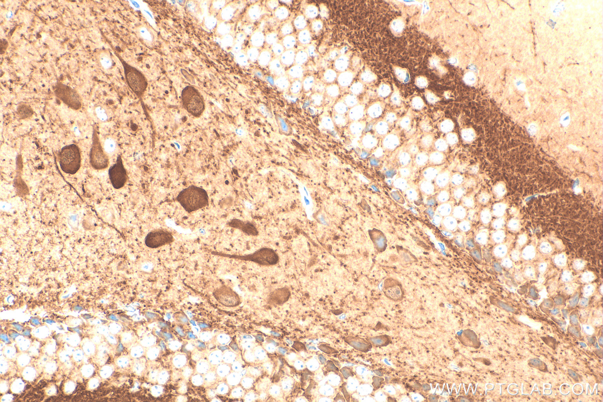 IHC staining of mouse brain using 82811-1-RR