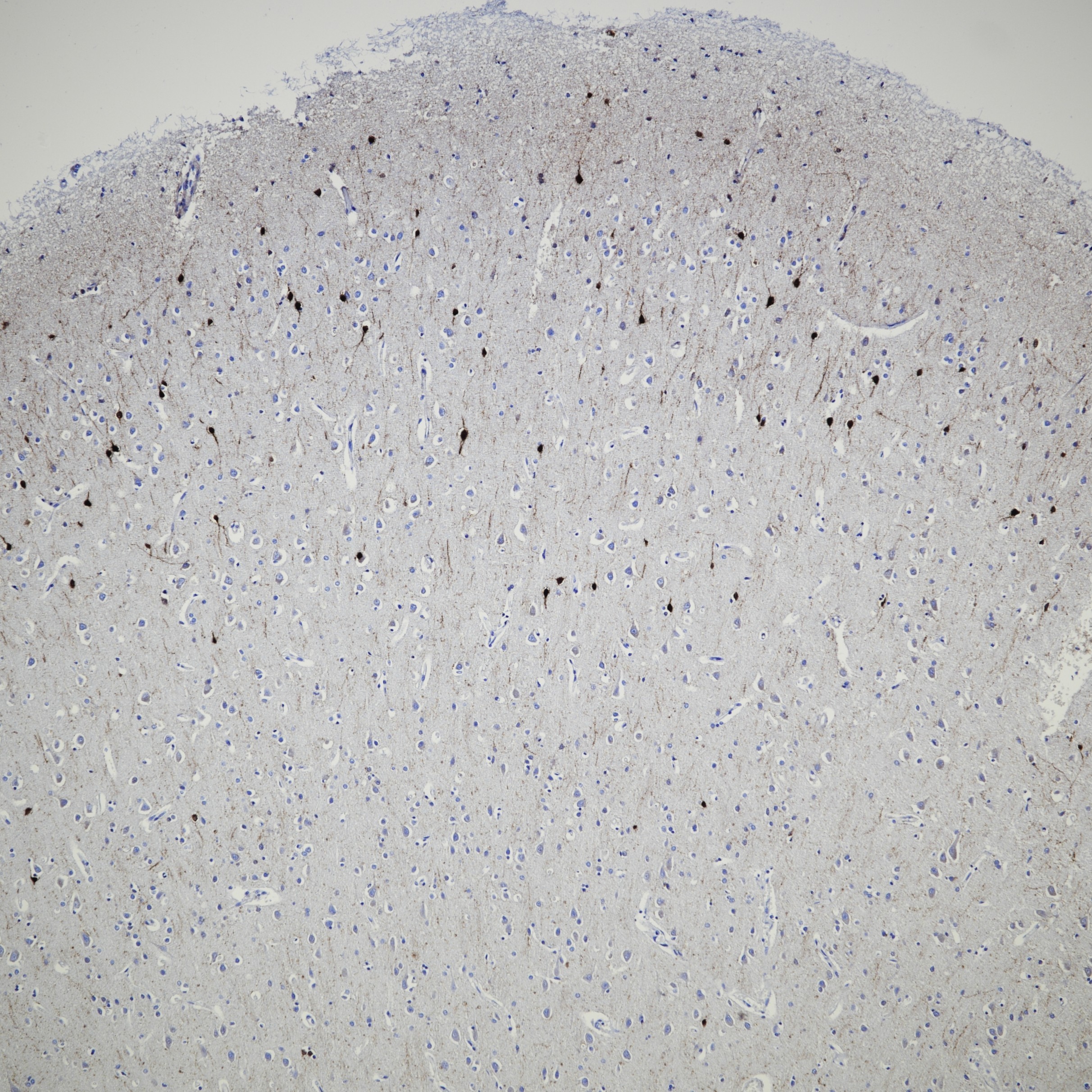 IHC staining of human brain using 82811-1-RR IHC staining of human brain using 82811-1-RR