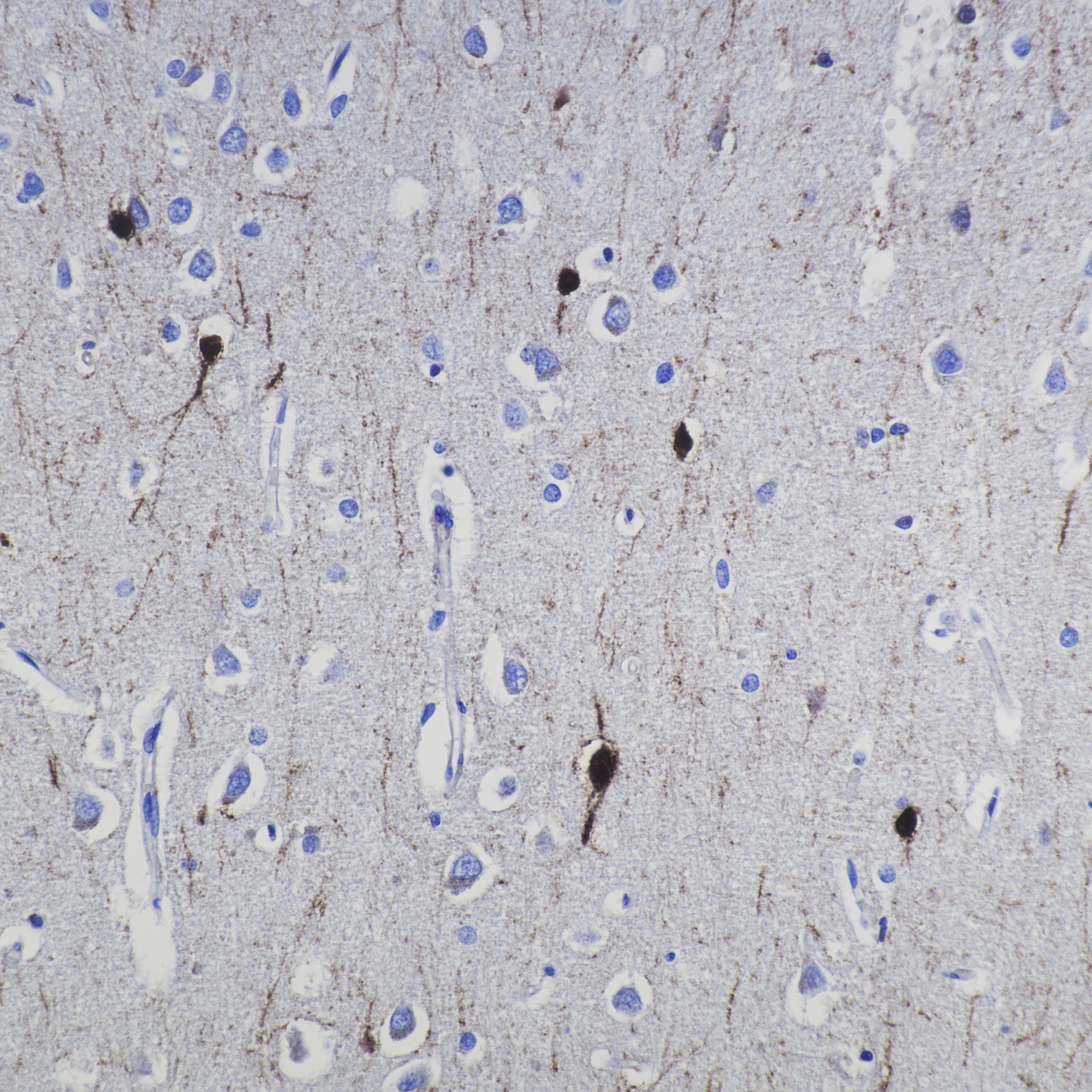 IHC staining of human brain using 82811-1-RR IHC staining of human brain using 82811-1-RR