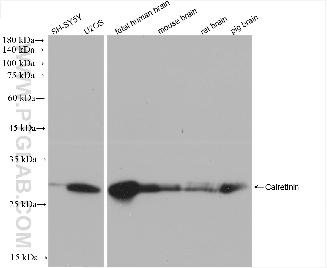 WB analysis using 82811-1-RR