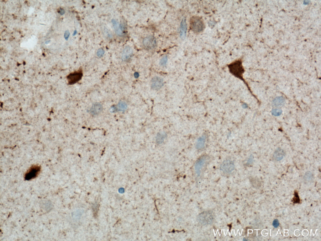 IHC staining of human brain using Biotin-66496