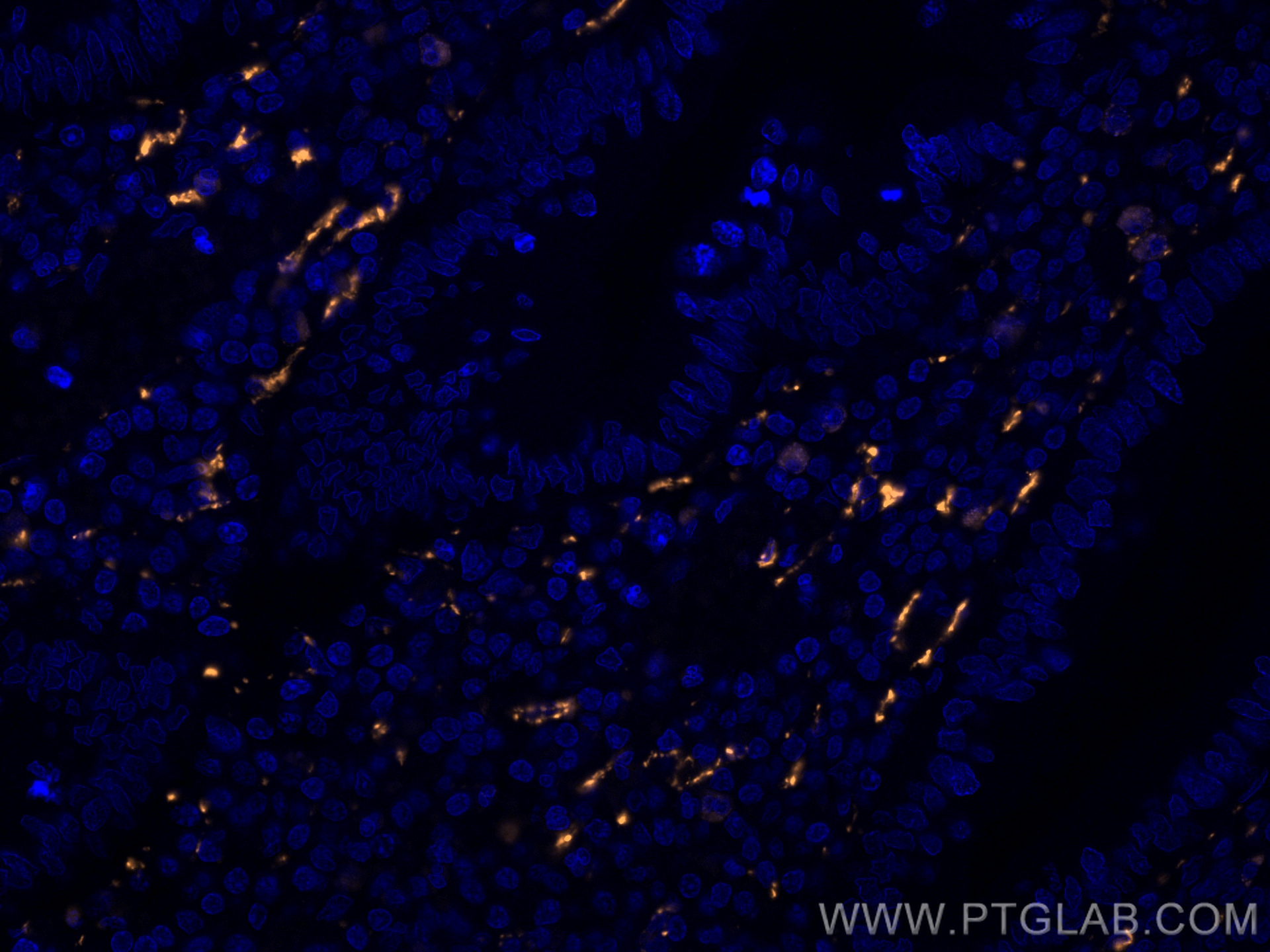 Calretinin