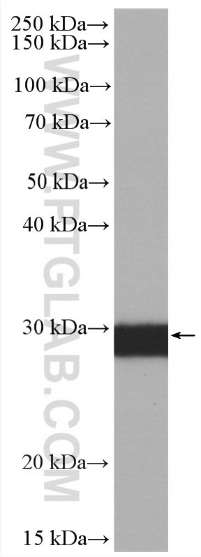 Calretinin