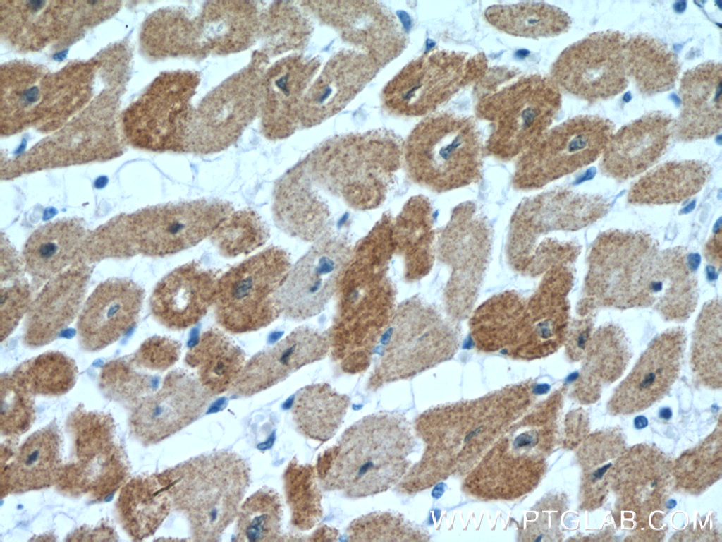 IHC staining of human heart using 27560-1-AP