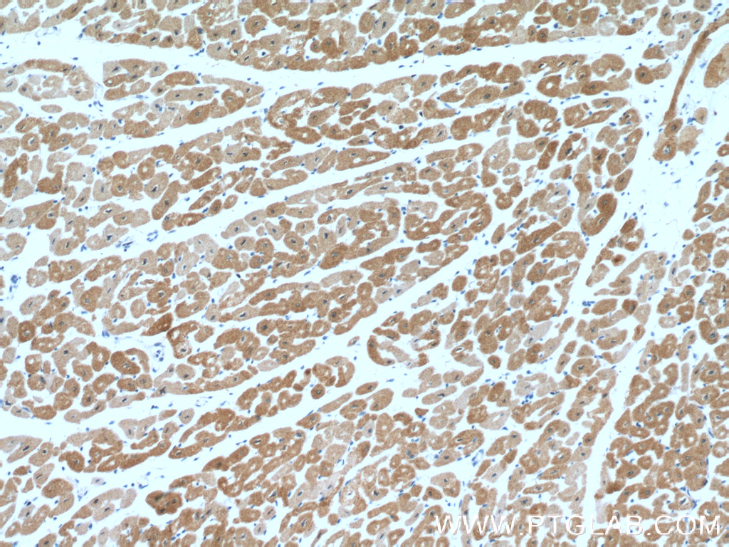 IHC staining of human heart using 27560-1-AP