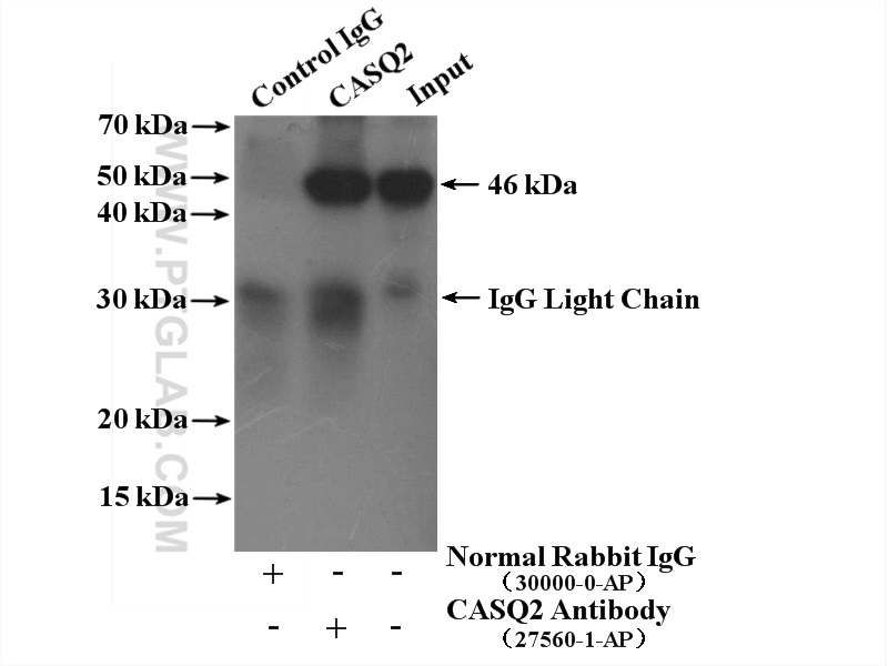 IP experiment of mouse heart using 27560-1-AP