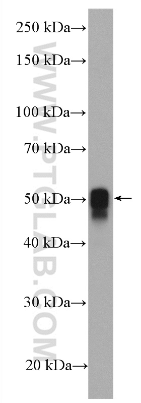 WB analysis of mouse heart using 27560-1-AP