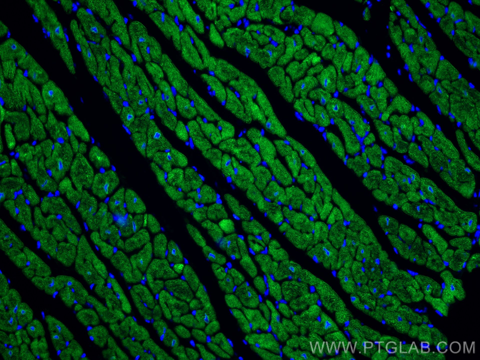 Calsequestrin 2