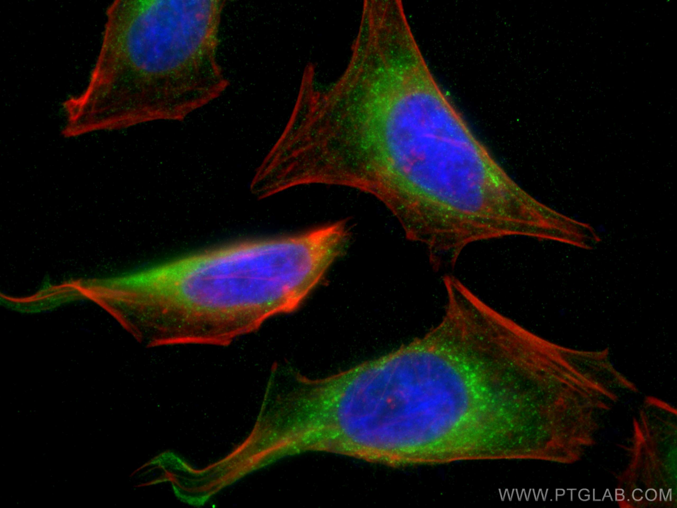 IF Staining of HeLa using 67585-1-Ig